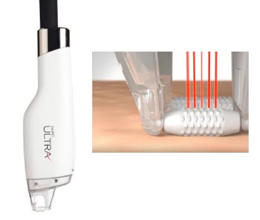 Lutronic LaseMD Ultra